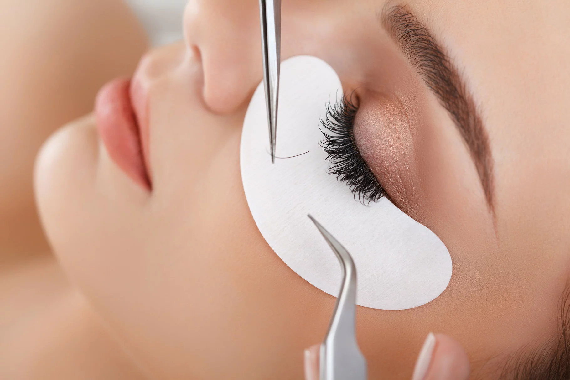 Eyelash Transplantation