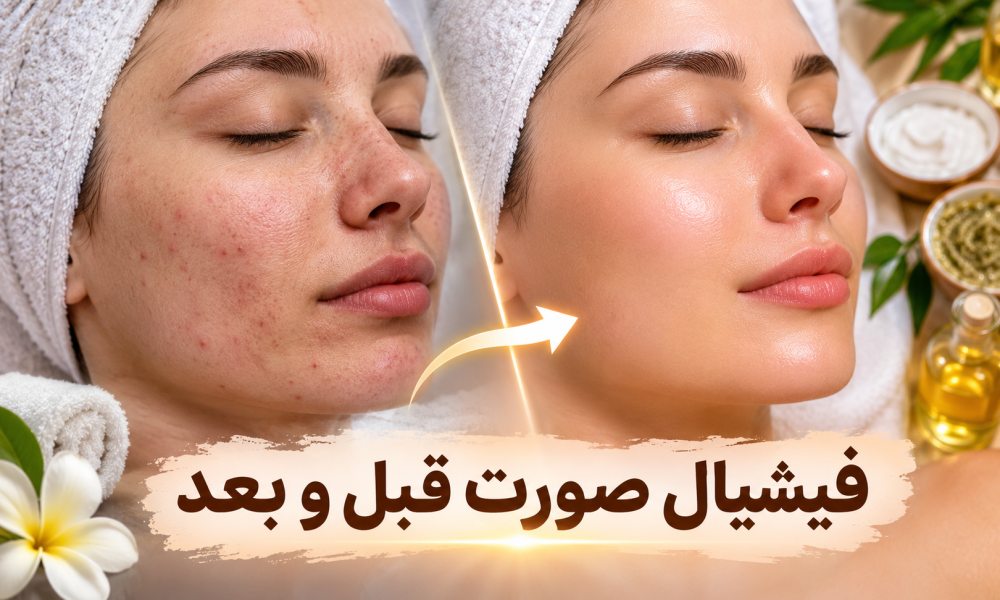بعد از فیشیال صورت چه تغییری می_کند؟