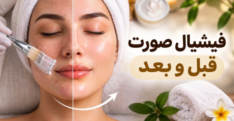 تصویر شاخص محتوای فیشیال صورت قبل و بعد؛ نتایج واقعی و نکات مراقبتی